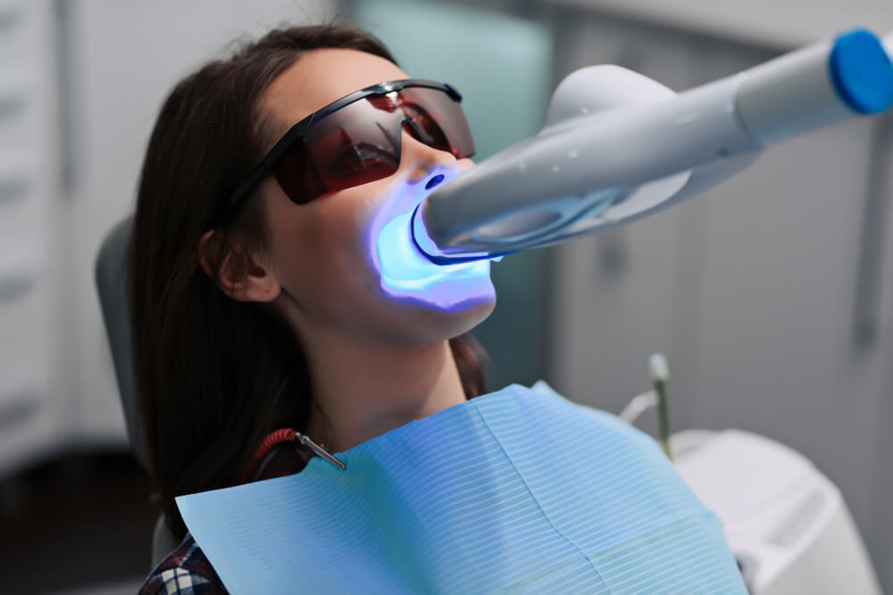 Teeth whitening